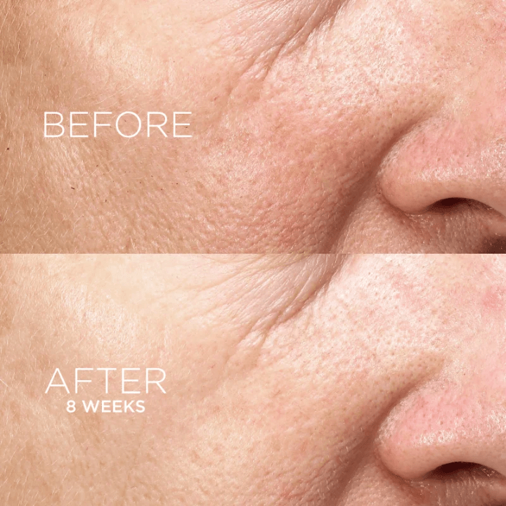Darphin Intral Inner Youth Rescue Serum