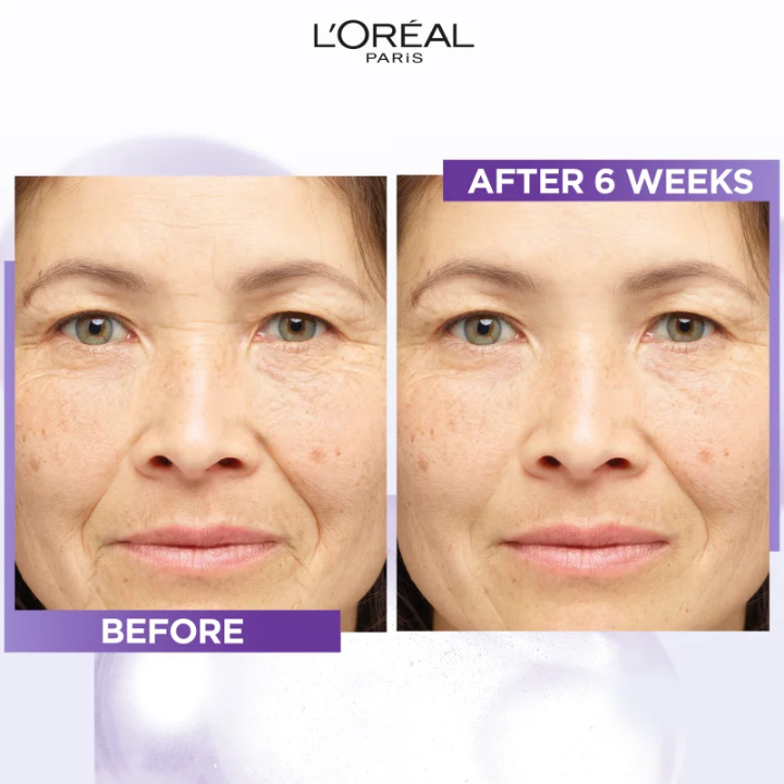 Revitalift Filler