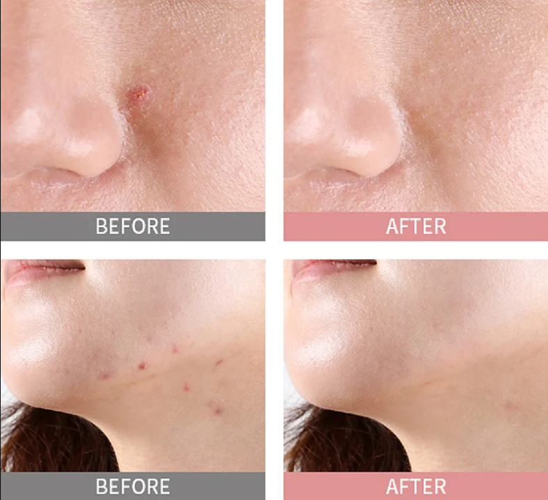 Mizon Good Bye Blemish Pink Spot